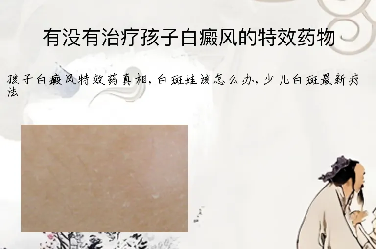 有没有治疗孩子白癜风的特效药物