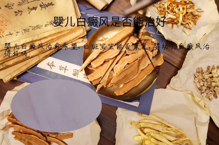 婴儿白癜风是否能治好
