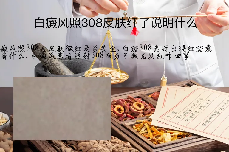 白癜风照308皮肤红了说明什么