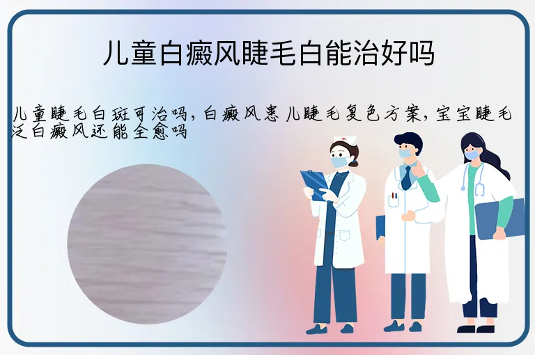 儿童白癜风睫毛白能治好吗