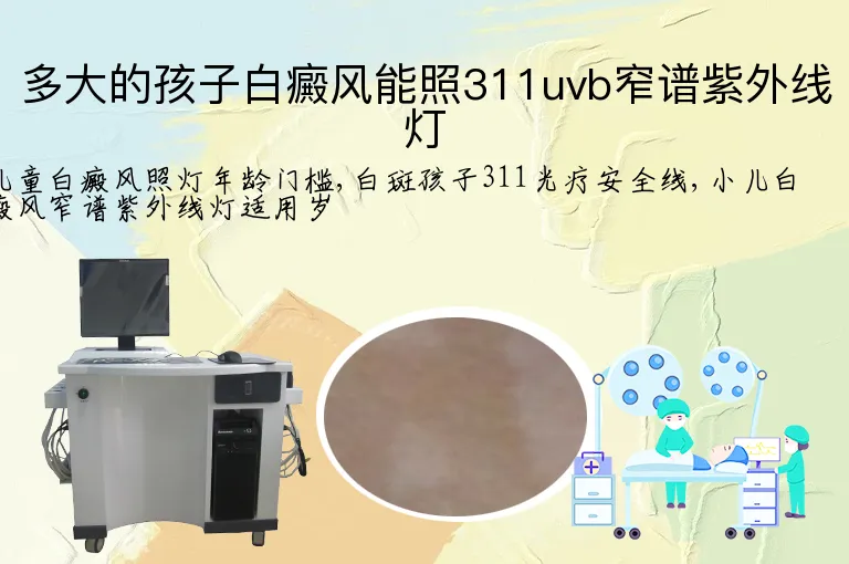 多大的孩子白癜风能照311uvb窄谱紫外线灯