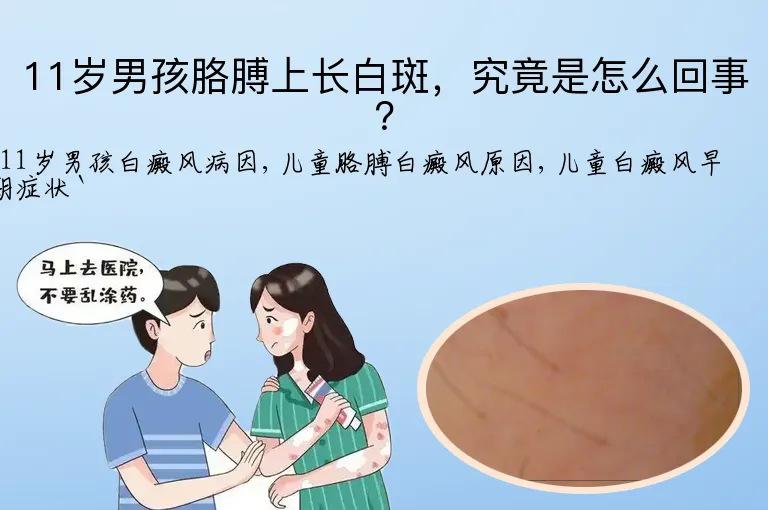 11岁男孩胳膊上长白斑，究竟是怎么回事？