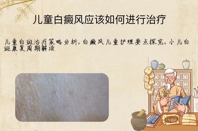 儿童白癜风应该如何进行治疗