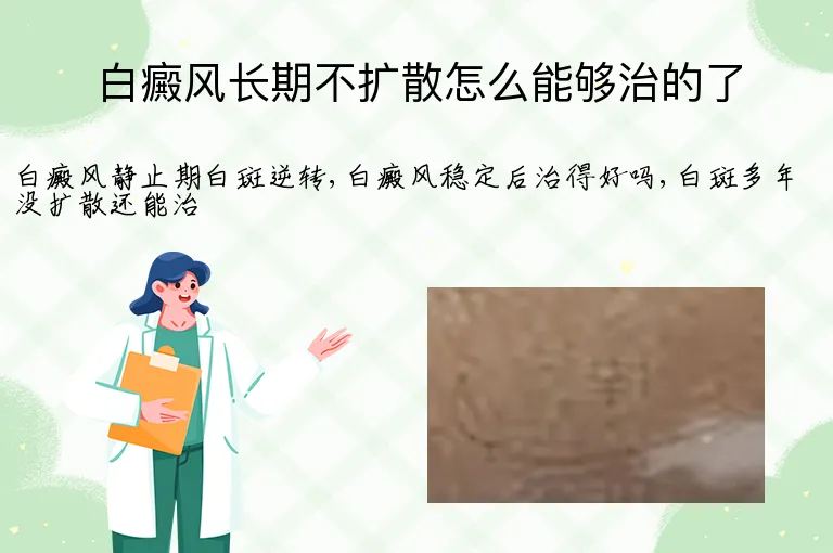 白癜风长期不扩散怎么能够治的了