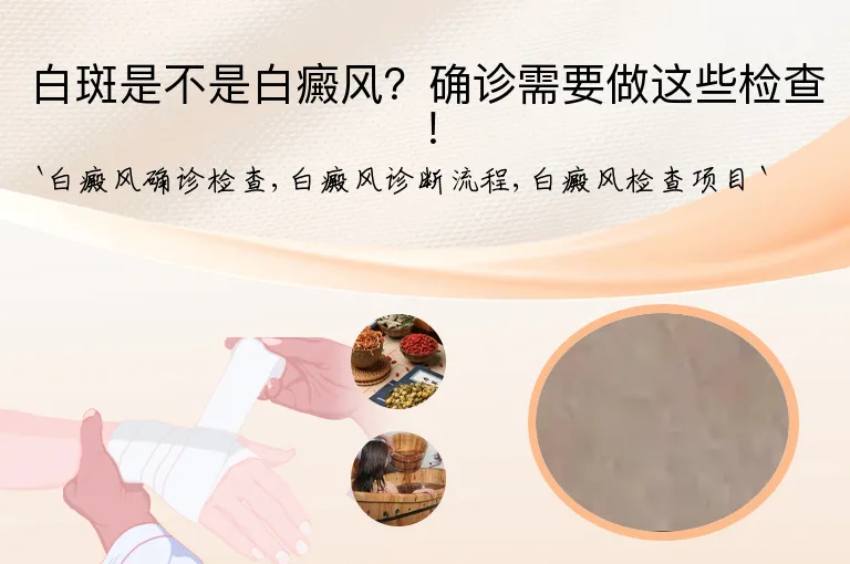 白斑是不是白癜风？确诊需要做这些检查！