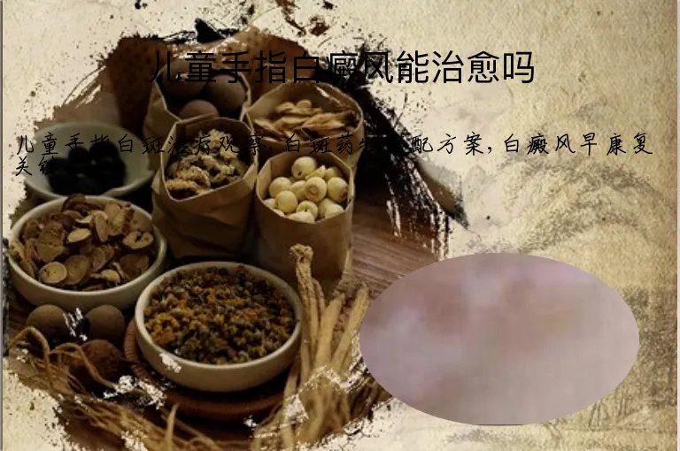 儿童手指白癜风能治愈吗