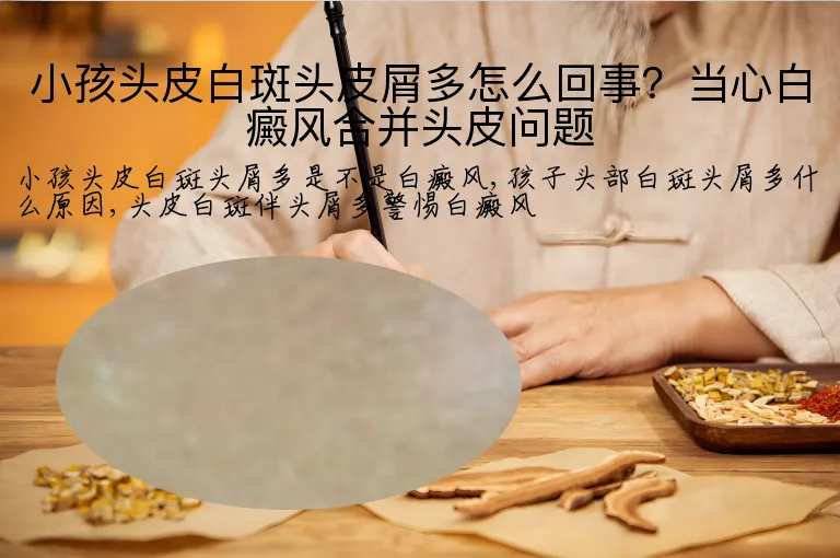 小孩头皮白斑头皮屑多怎么回事?当心白癜风合并头皮问题