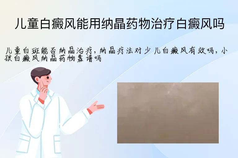 儿童白癜风能用纳晶药物治疗白癜风吗