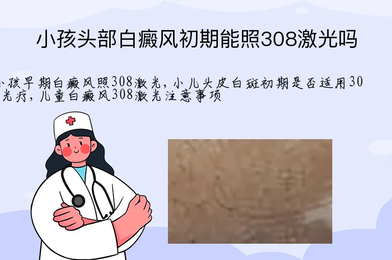 小孩头部白癜风初期能照308激光吗
