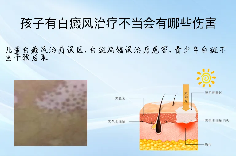 孩子有白癜风治疗不当会有哪些伤害