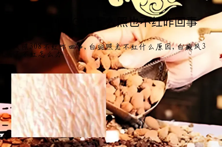 白癜风照308怎么照也不红咋回事