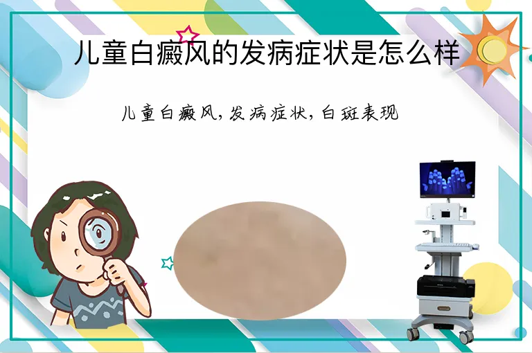 儿童白癜风的发病症状是怎么样