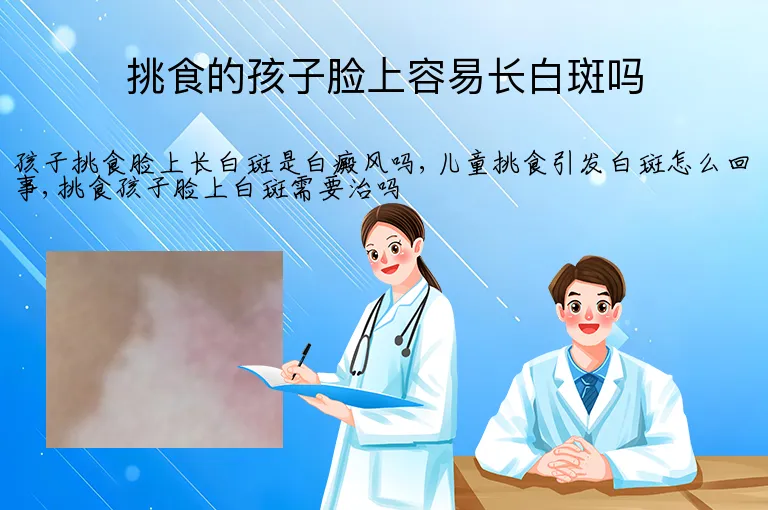 挑食的孩子脸上容易长白斑吗
