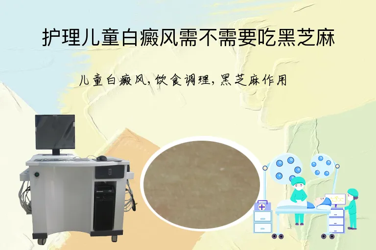 护理儿童白癜风需不需要吃黑芝麻