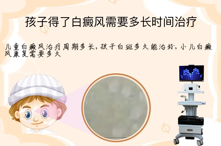 孩子得了白癜风需要多长时间治疗