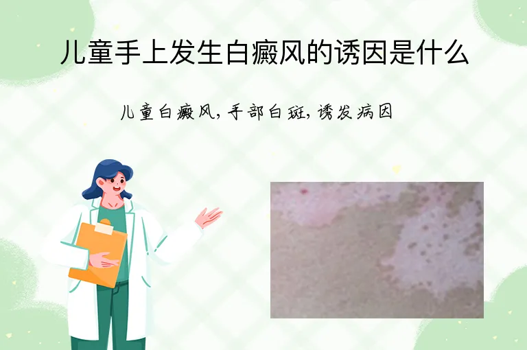 儿童手上发生白癜风的诱因是什么