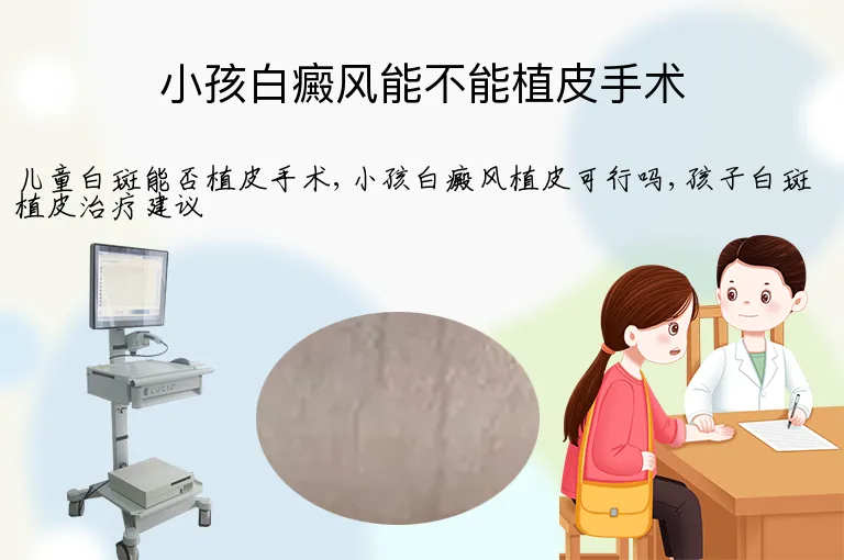 小孩白癜风能不能植皮手术