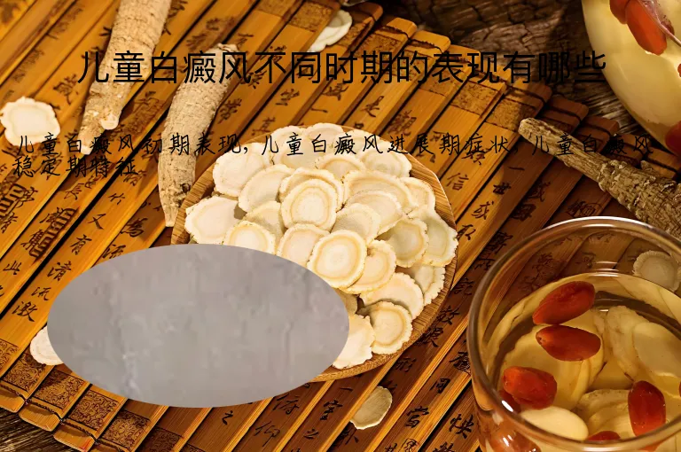儿童白癜风不同时期的表现有哪些