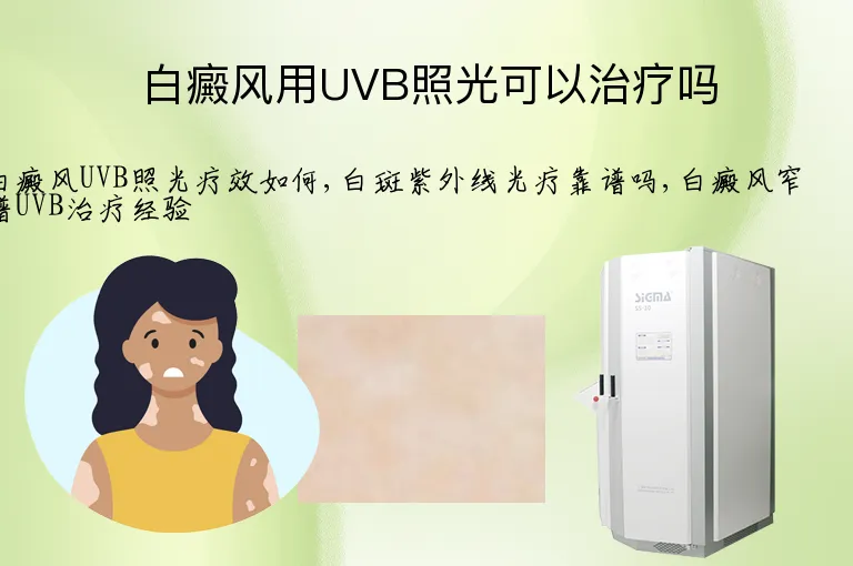 白癜风用UVB照光可以治疗吗
