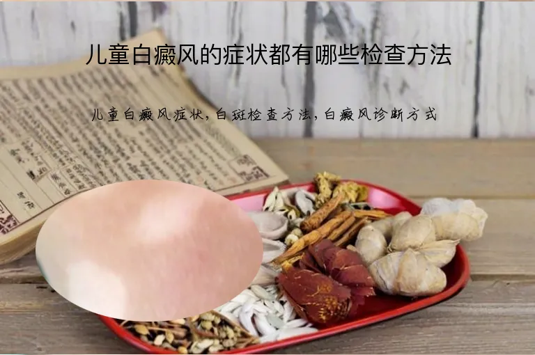 儿童白癜风的症状都有哪些检查方法