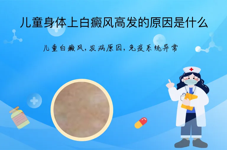儿童身体上白癜风高发的原因是什么