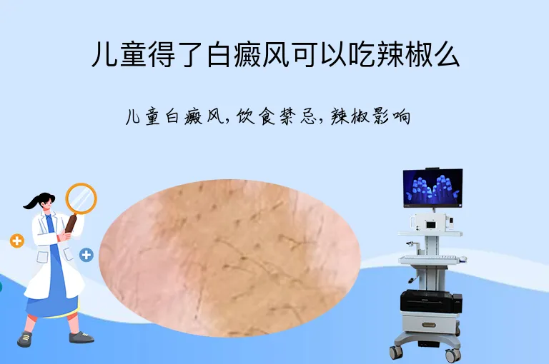 儿童得了白癜风可以吃辣椒么