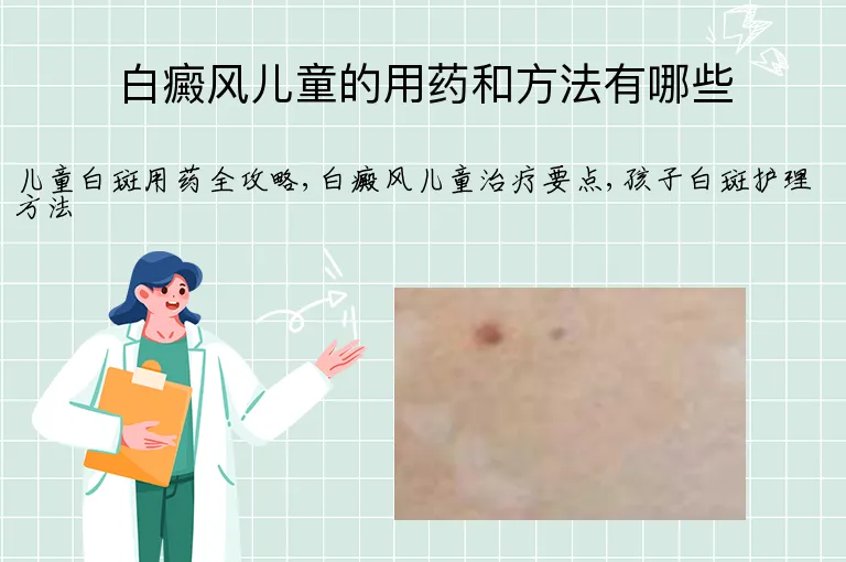 白癜风儿童的用药和方法有哪些