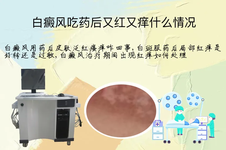 白癜风吃药后又红又痒什么情况