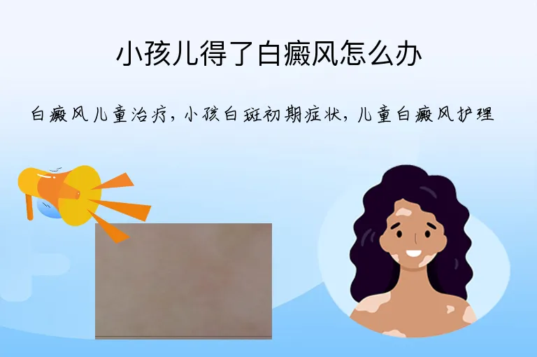 小孩儿得了白癜风怎么办