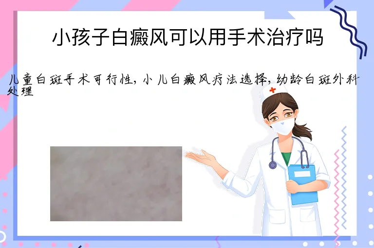 小孩子白癜风可以用手术治疗吗
