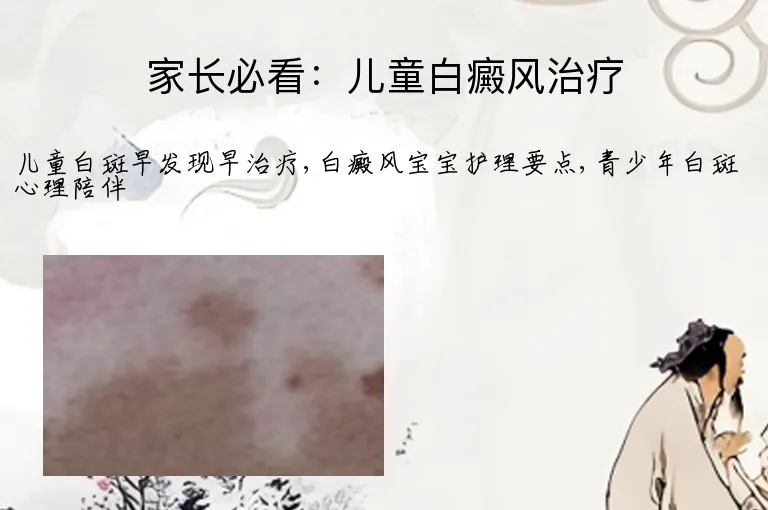 家长必看：儿童白癜风治疗