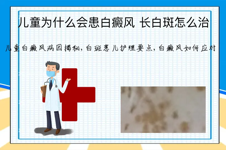 儿童为什么会患白癜风 长白斑怎么治