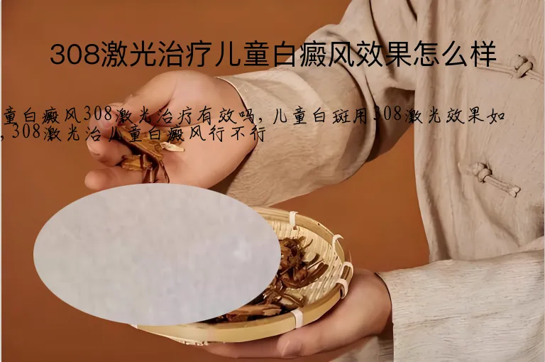 308激光治疗儿童白癜风效果怎么样