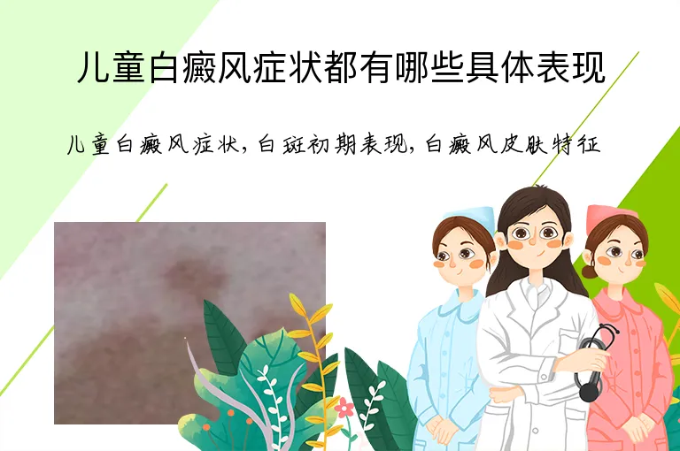 儿童白癜风症状都有哪些具体表现