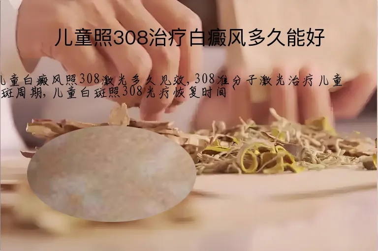 儿童照308治疗白癜风多久能好