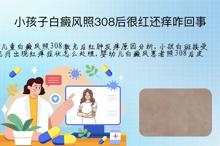 小孩子白癜风照308后很红还痒咋回事
