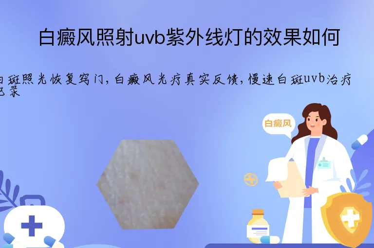 白癜风照射uvb紫外线灯的效果如何