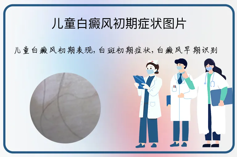儿童白癜风初期症状图片