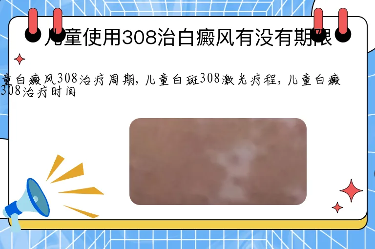 儿童使用308治白癜风有没有期限