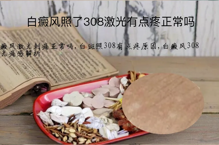 白癜风照了308激光有点疼正常吗
