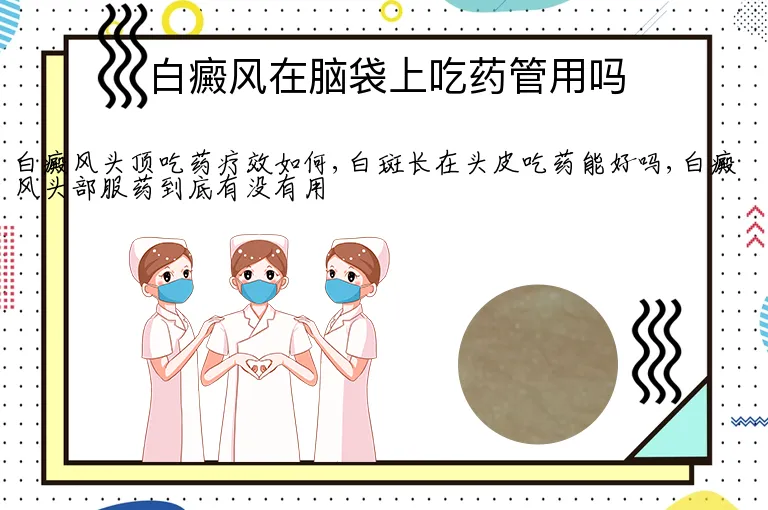 白癜风在脑袋上吃药管用吗