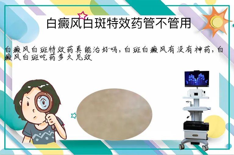 白癜风白斑特效药管不管用