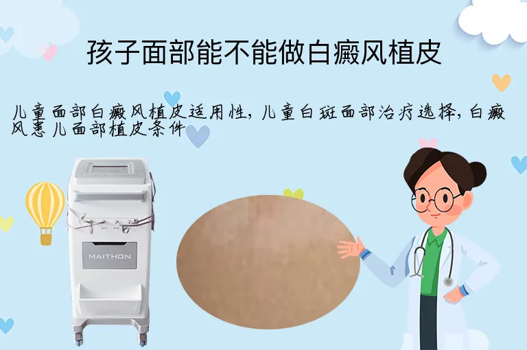 孩子面部能不能做白癜风植皮