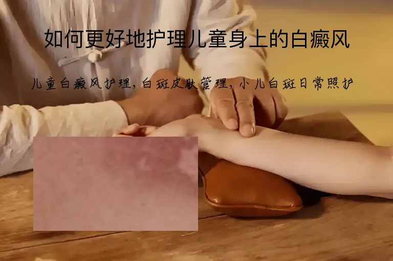 如何更好地护理儿童身上的白癜风