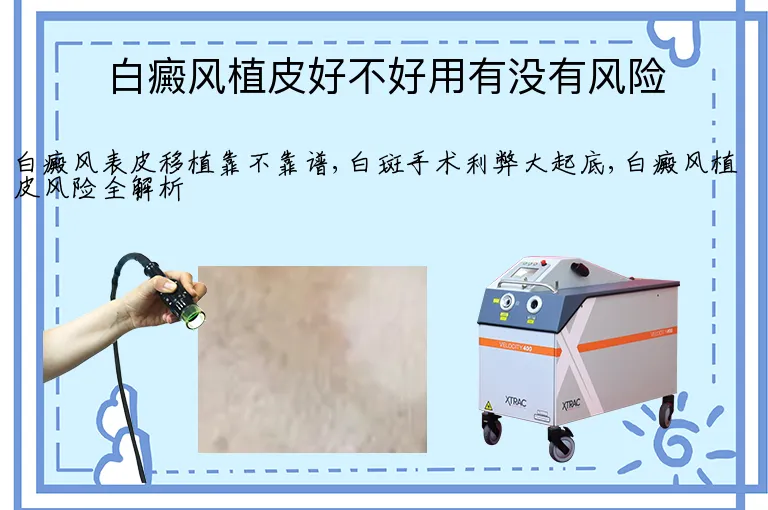白癜风植皮好不好用有没有风险
