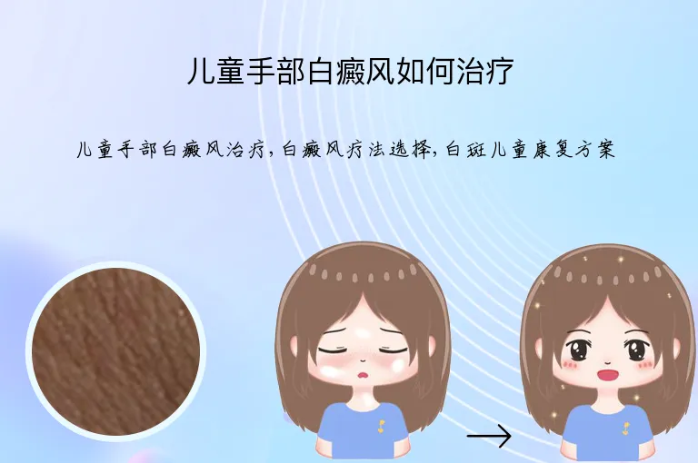 儿童手部白癜风如何治疗