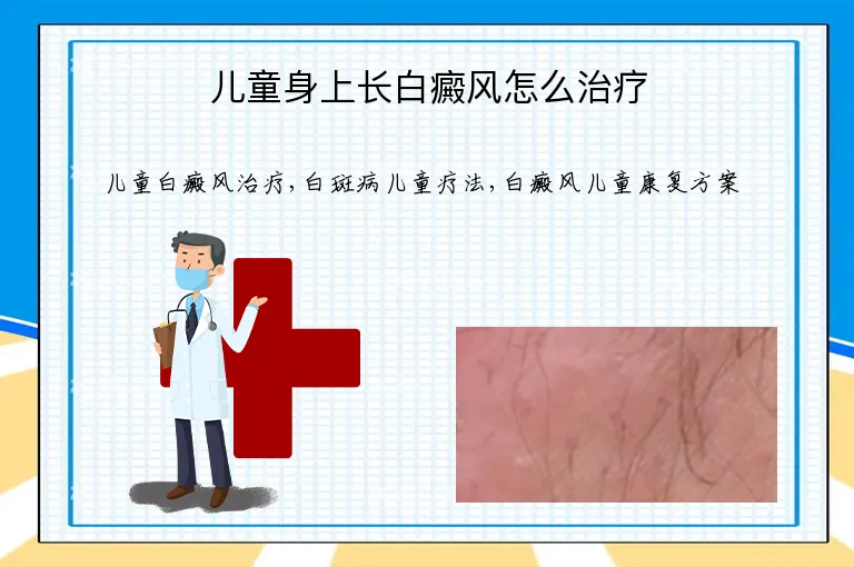 儿童身上长白癜风怎么治疗