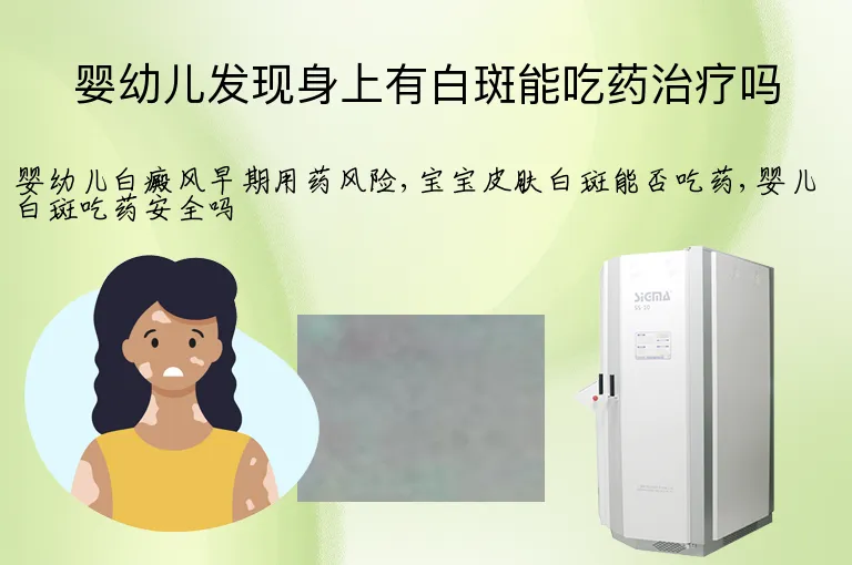 婴幼儿发现身上有白斑能吃药治疗吗