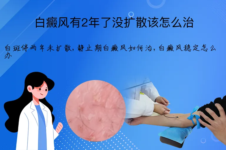 白癜风有2年了没扩散该怎么治