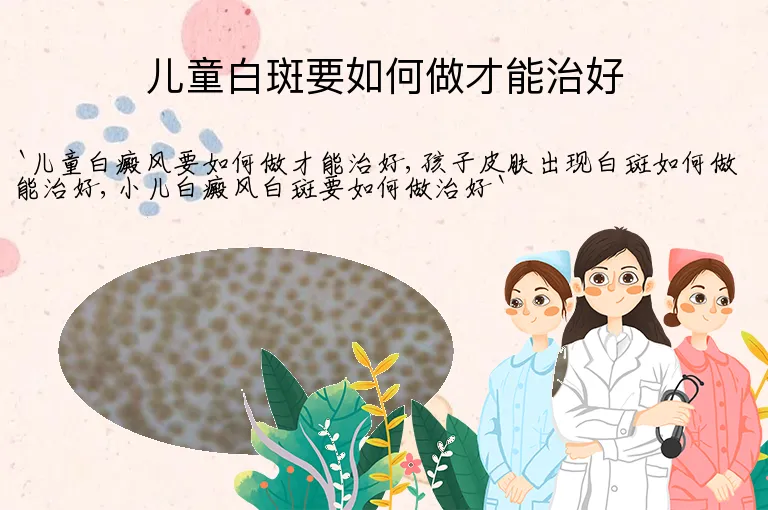 儿童白斑要如何做才能治好